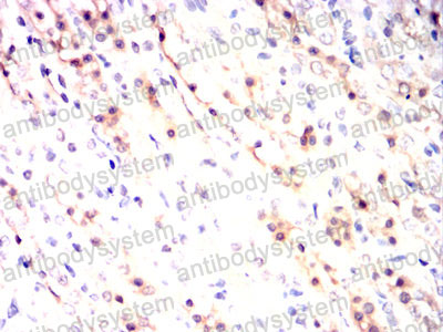 Валидация AntibodySystem RHF94401