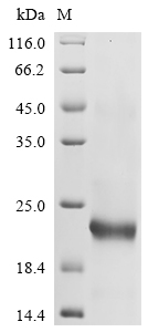 SDS-PAGE