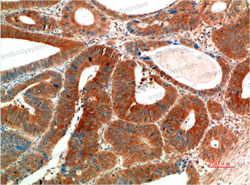 Валидация AntibodySystem RHD73611 (1771)