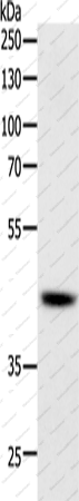 Вестерн-блоттинг, SOX-7, ткань лимфомы человека