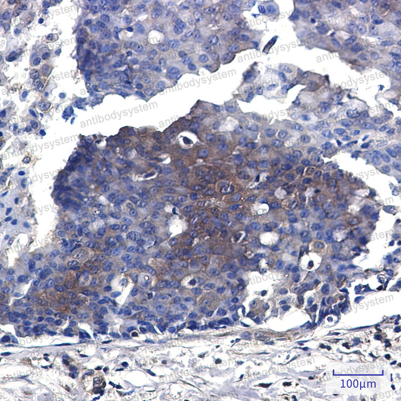 Валидация AntibodySystem RHE17801