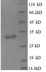 SDS-PAGE