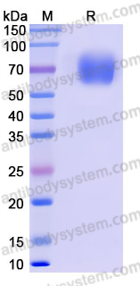 AHK27204, SDS-PAGE