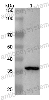 Валидация AntibodySystem PHB79501