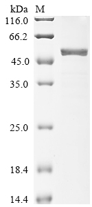 SDS-PAGE