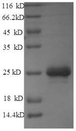 SDS-PAGE