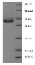 SDS-PAGE