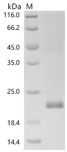 SDS-PAGE