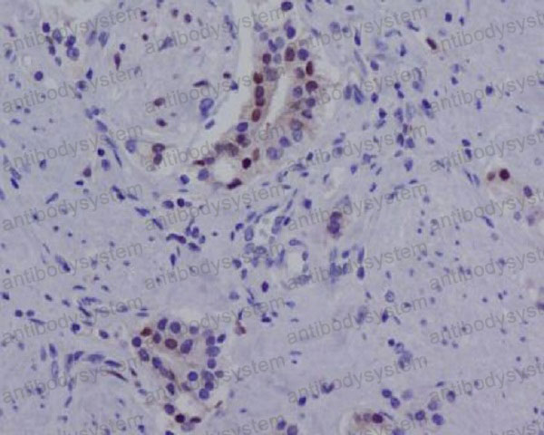 Валидация AntibodySystem RHC80301