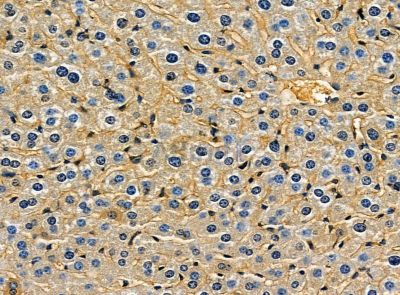 Валидация Affinity DF14187 - 10005