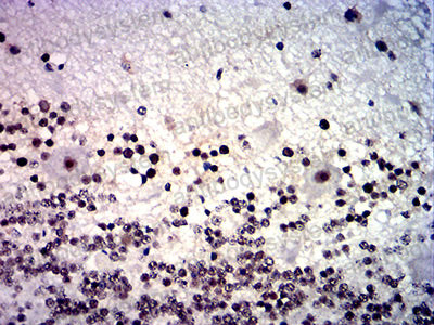 Валидация AntibodySystem RHC07601