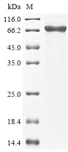 SDS-PAGE