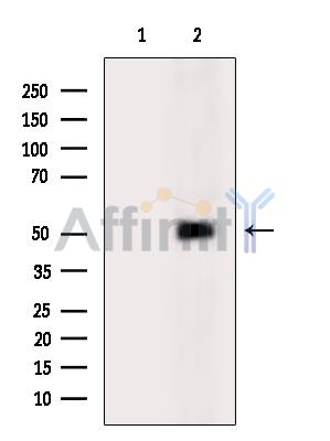 Валидация Affinity DF13815 - 9498