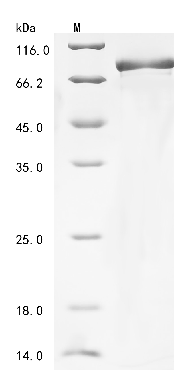 SDS-PAGE