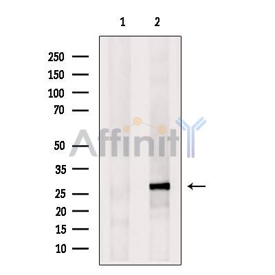 Валидация Affinity DF8652 - 20614