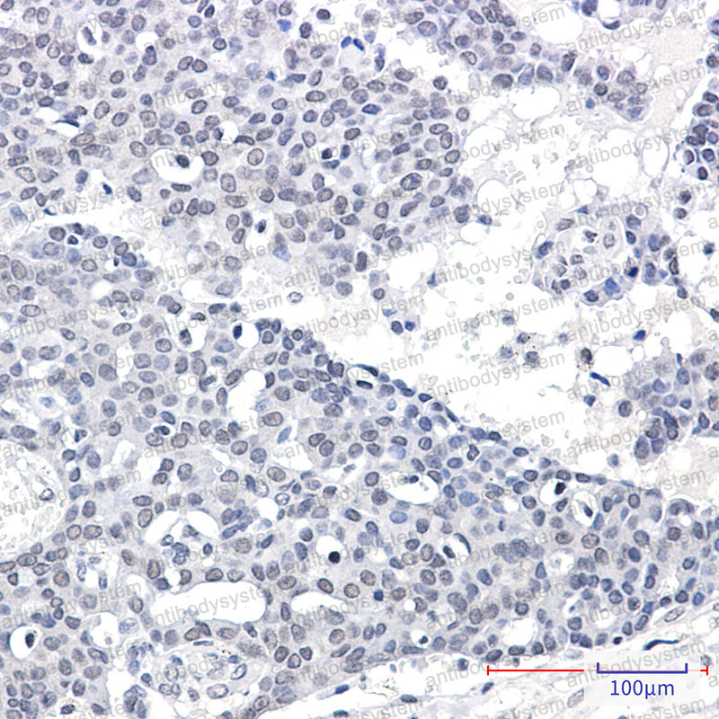 Валидация AntibodySystem RHA07601