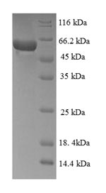 SDS-PAGE