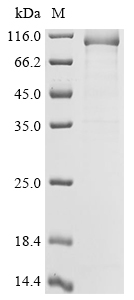SDS-PAGE