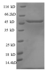 SDS-PAGE