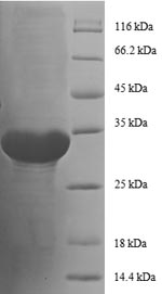 SDS-PAGE