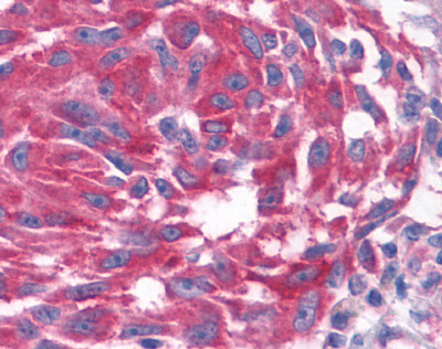 Валидация AssayVector ARM1061(178)