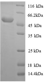 SDS-PAGE