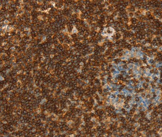 Иммуногистохимия, CD43, ткань миндалин человека