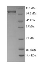 SDS-PAGE