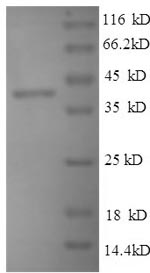 SDS-PAGE