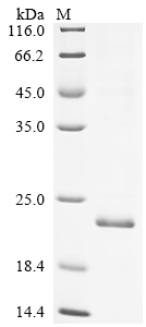 SDS-PAGE