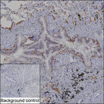 Валидация AntibodySystem RHE44606