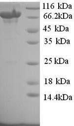 SDS-PAGE