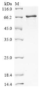 SDS-PAGE
