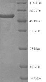 SDS-PAGE