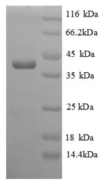 SDS-PAGE