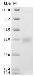 SDS-PAGE