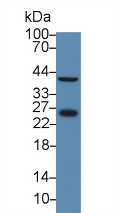 13955