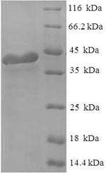 SDS-PAGE