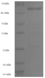 SDS-PAGE