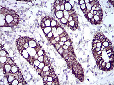 Валидация AntibodySystem RHG31404