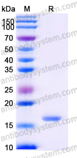 YHJ59402, SDS-PAGE