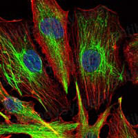 Валидация IF - AntibodySystem RHH89201