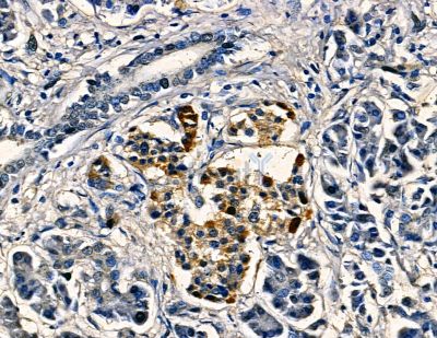 Валидация Affinity DF13766 - 9428