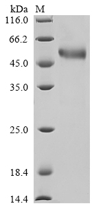 SDS-PAGE