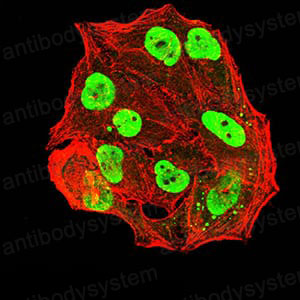 Валидация IF - AntibodySystem RHC03210