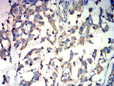 Валидация AntibodySystem RHD67602 (1706)