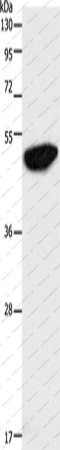 Вестерн-блоттинг, ENO2, клетки Jurkat