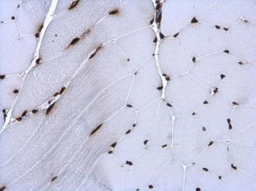 Валидация AssayVector ARM2686(5086)