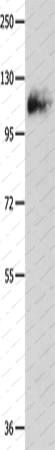Вестерн-блоттинг, Amphiphysin I, ткань легкого мыши