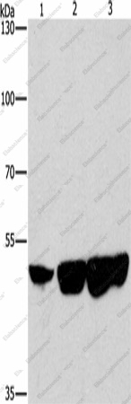 Вестерн-блоттинг, CTBP2, клетки HeLa, HepG2 и 231